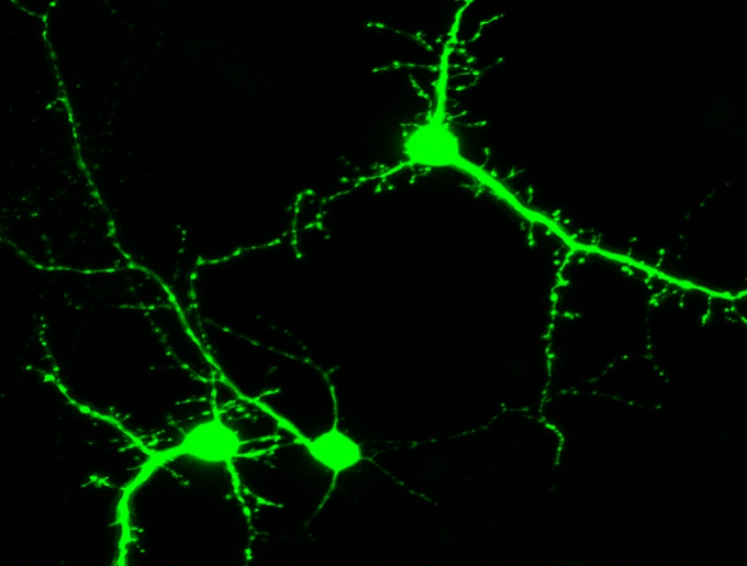 Green Neuron Image
